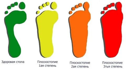 Возрастная стопа