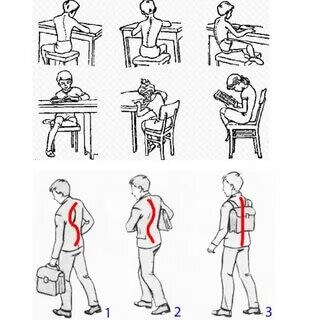 Правильная осанка