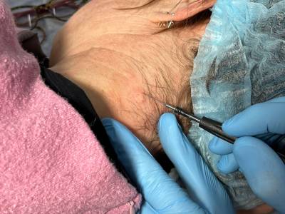 После удаления