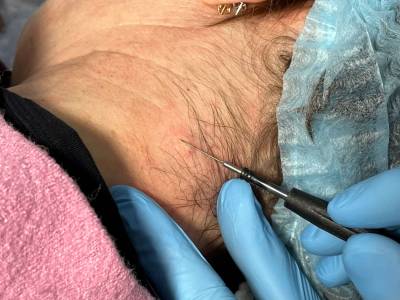 После удаления