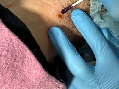 После удаления