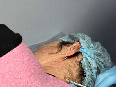 До удаления