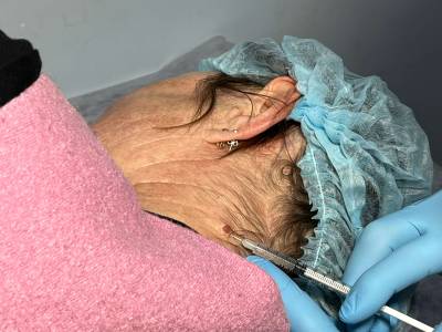 До удаления