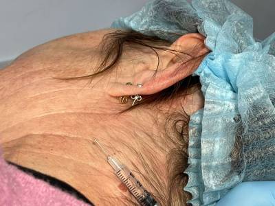 До удаления